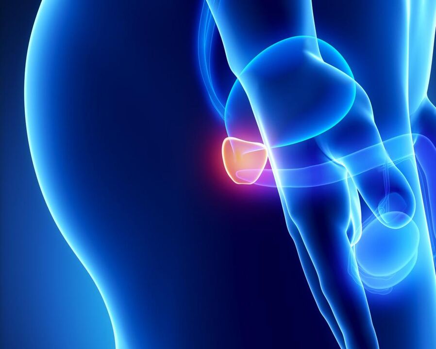 Inflamación da próstata